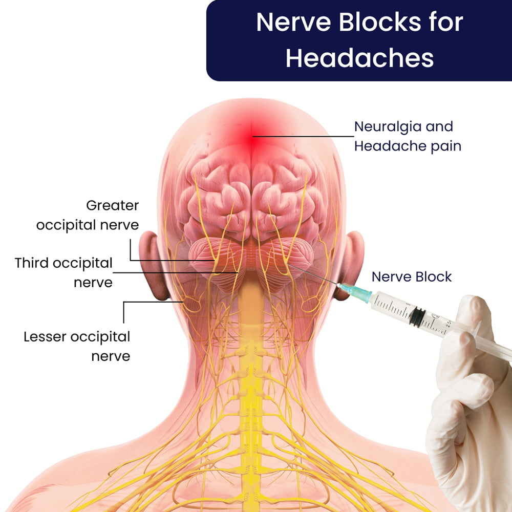 BiS　NERVE GUMOUT SUPER PENETRATING OIL (29219)