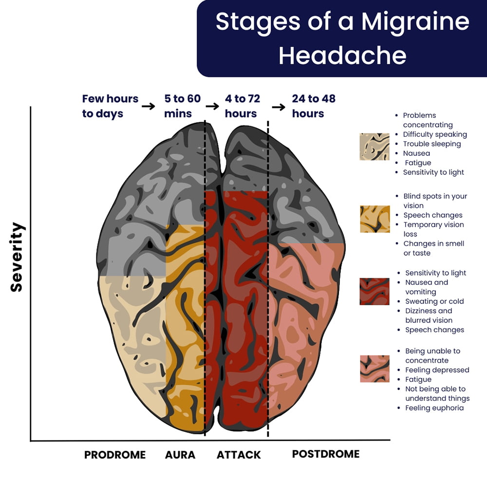Stages of a Migraine Headache