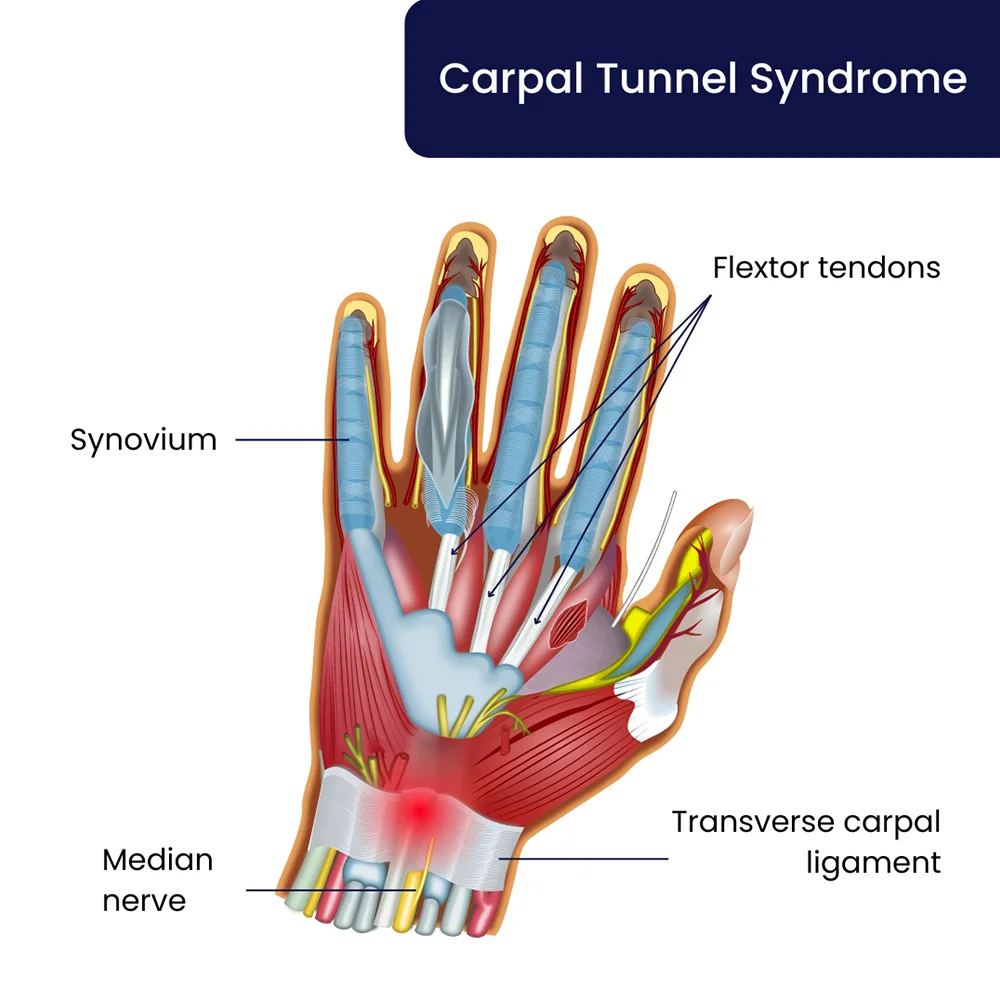 Carpal Tunnel Anatomy 3911x2550