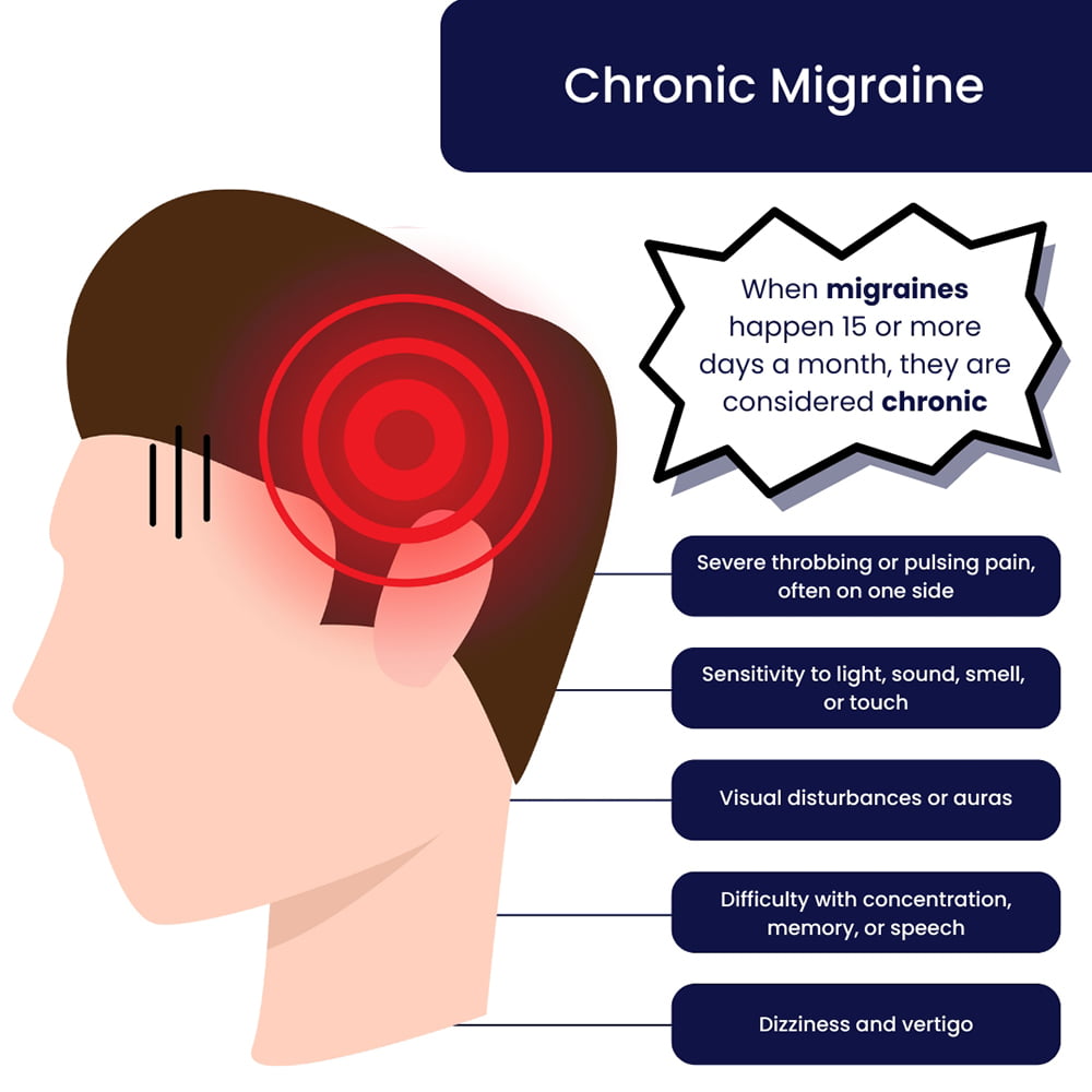 Chronic Migraines