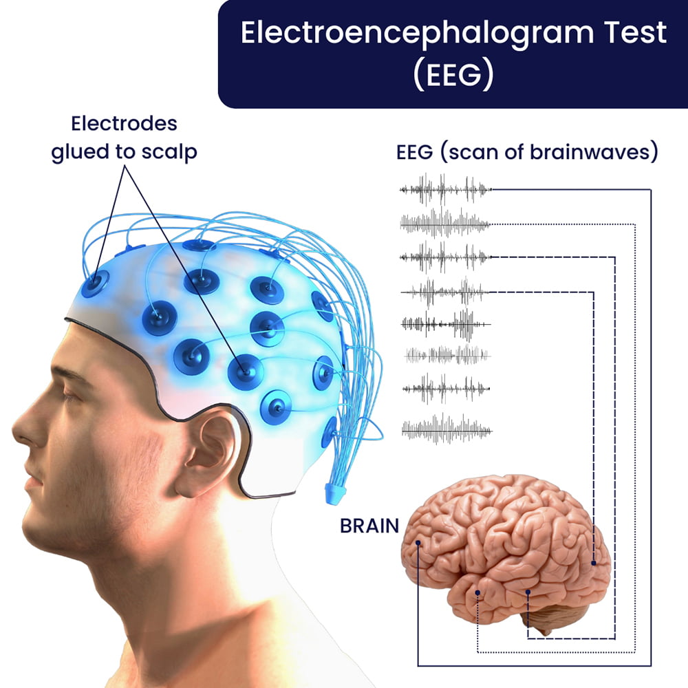 How To Clean Eeg Electrodes