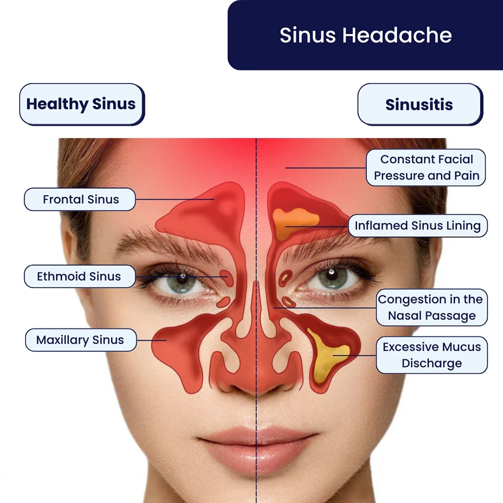 Sinus Headaches Specialist in Brooklyn, NYC \u0026 NJ, image size:1000x1000