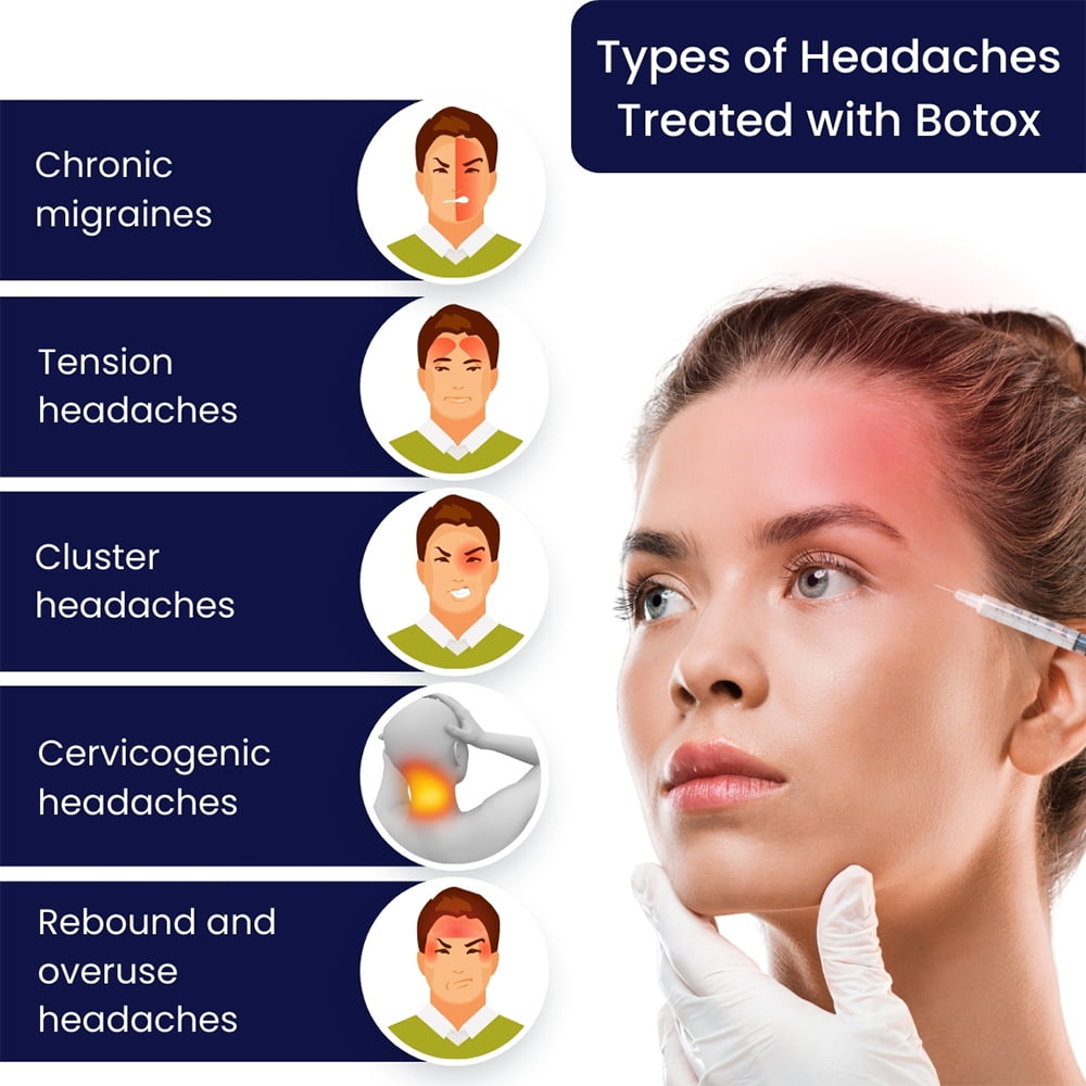 Types of Headaches Treated with Botox