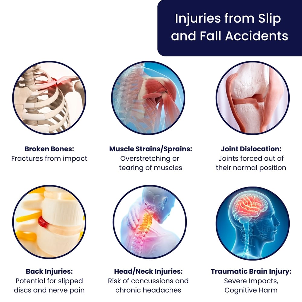 Type of Injuries Can a Slip and Fall Accident Cause