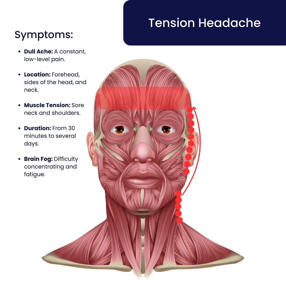 Tension Headache Symptoms