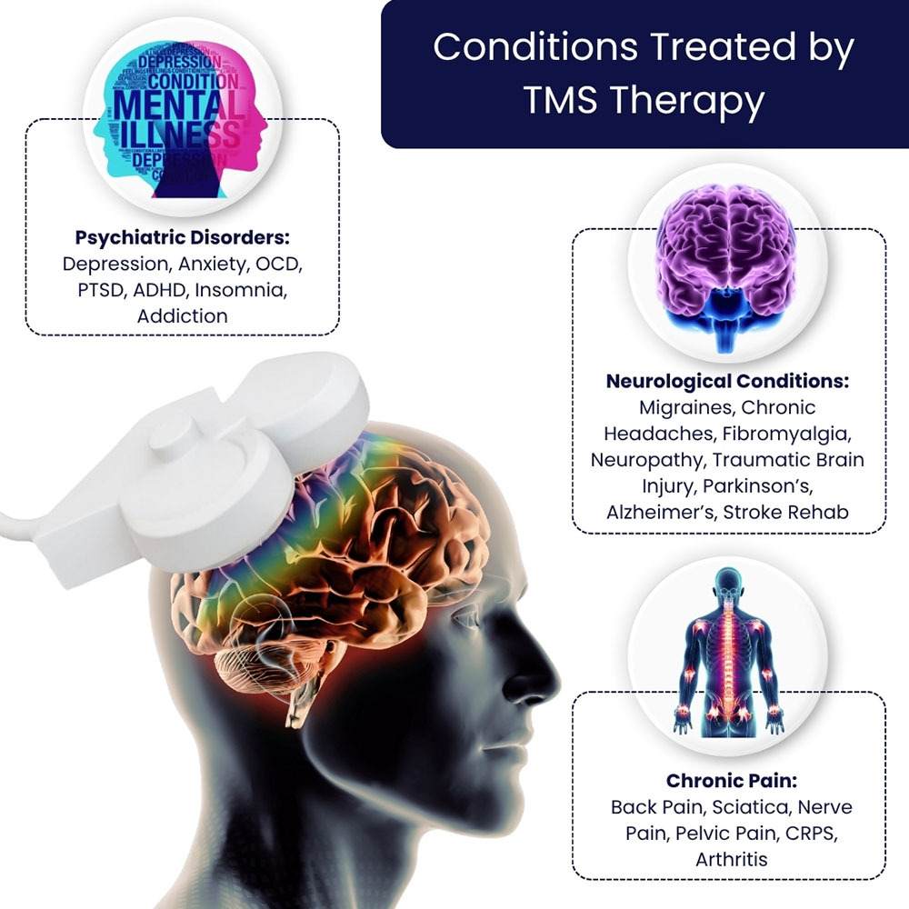 Conditions Treated By TMS Therapy