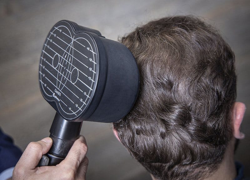 TMS for Migraine Headaches